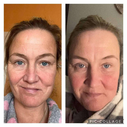 NeoCell Collagen Bio-Peptides – Rejuvenece Desde Dentro