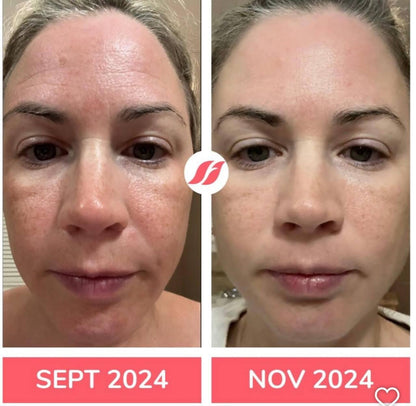 NeoCell Collagen Bio-Peptides – Rejuvenece Desde Dentro