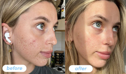 NeoCell Collagen Bio-Peptides – Rejuvenece Desde Dentro