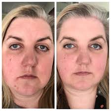 NeoCell Collagen Bio-Peptides – Rejuvenece Desde Dentro