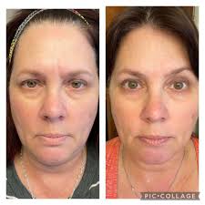 NeoCell Collagen Bio-Peptides – Rejuvenece Desde Dentro